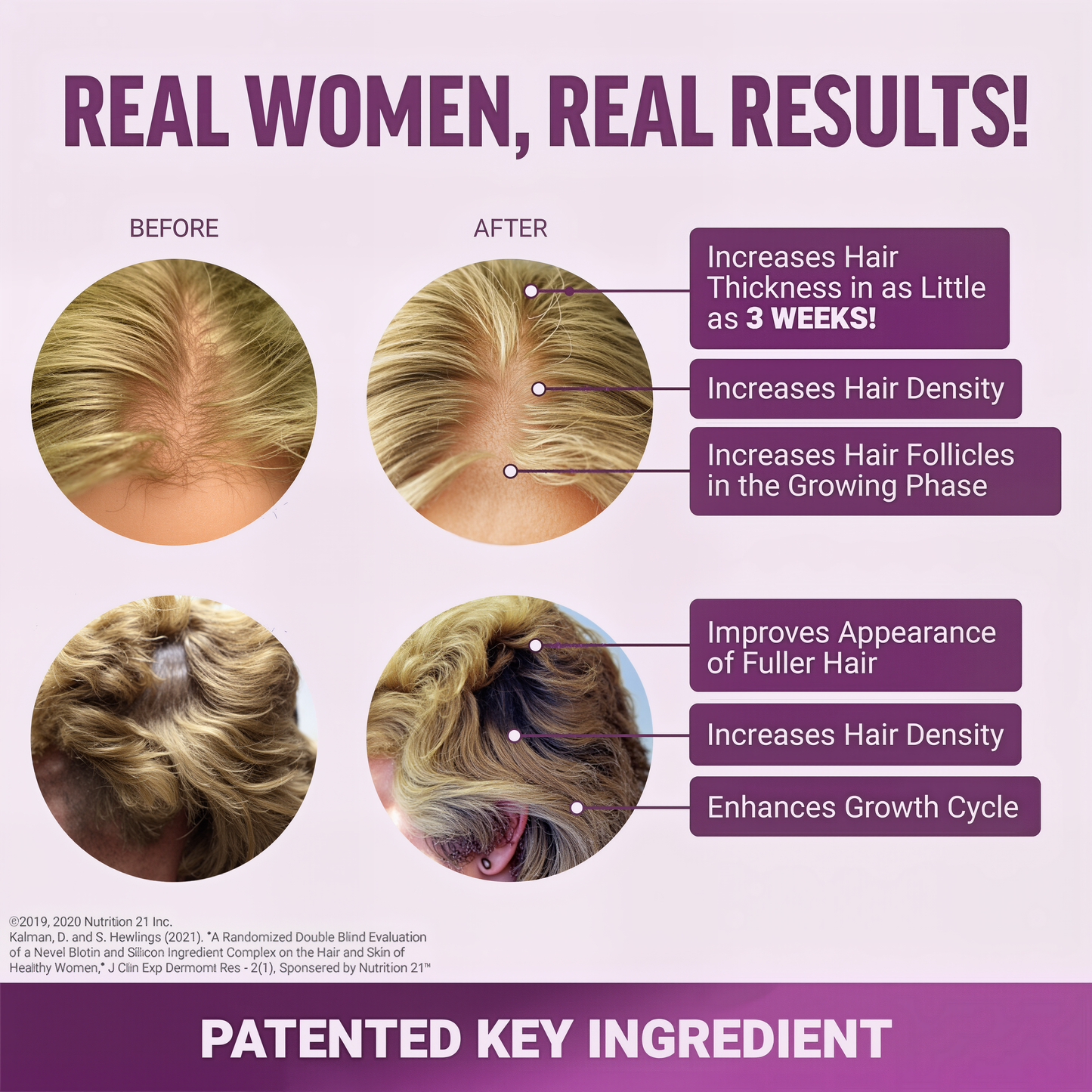 Voguezy - Hair Growth Accelerator