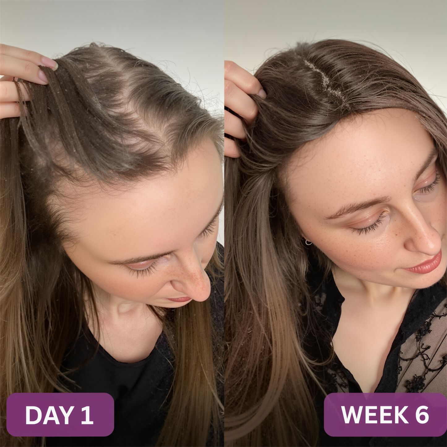 Voguezy - Hair Growth Accelerator