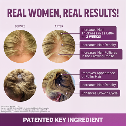 Voguezy - Hair Growth Accelerator